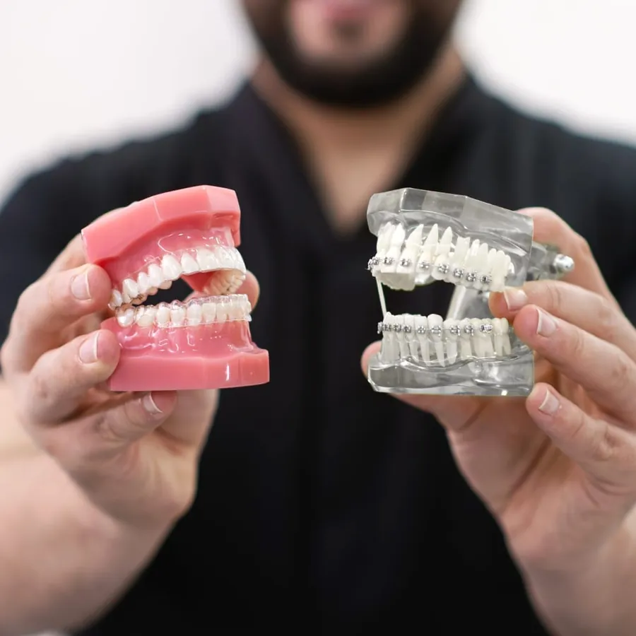 Clear aligners and braces shown together