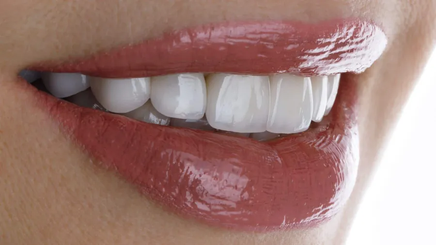 Dental care focusing on smile aesthetics