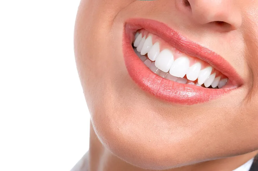 Teeth whitening treatment in a dental practice